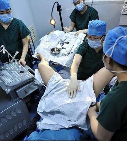 试管婴儿过程,试管婴儿手术取卵疼吗?- _感人网