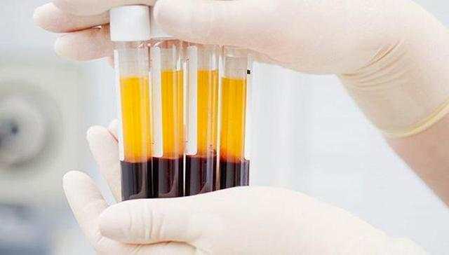 「血浆」深圳新冠肺炎痊愈者发声:我要捐血浆!“非典”时期深圳曾用康复者血清抢救重症患者