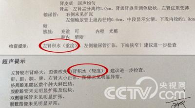 生活早参考:政府通告病毒灵体检报告疑似造假