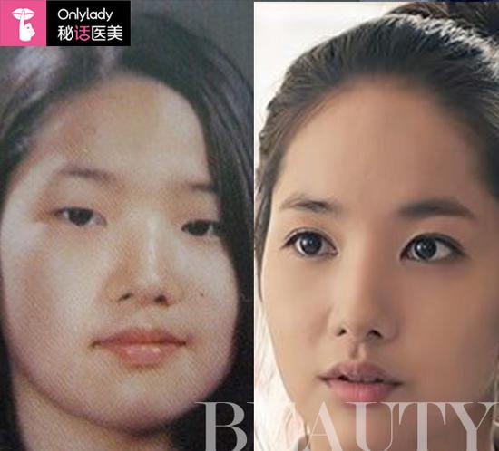 朴敏英终成大美女 整容最厉害<em>韩国女星</em>_粤语台