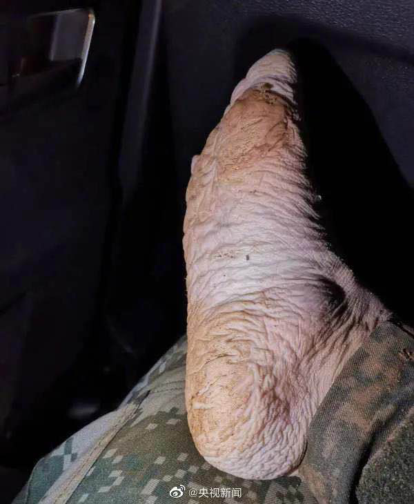 8点见|【8点见】6万粉丝“大V”直播大闹医院，护士请出440万粉丝的医生一起直播，结果……