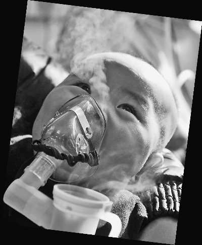 霾来袭 PM2。5微颗粒种下健康隐患