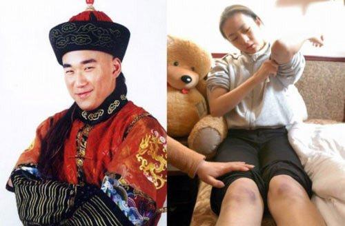 明星打人层出不穷 刘烨过招老外李亚鹏打狗仔-