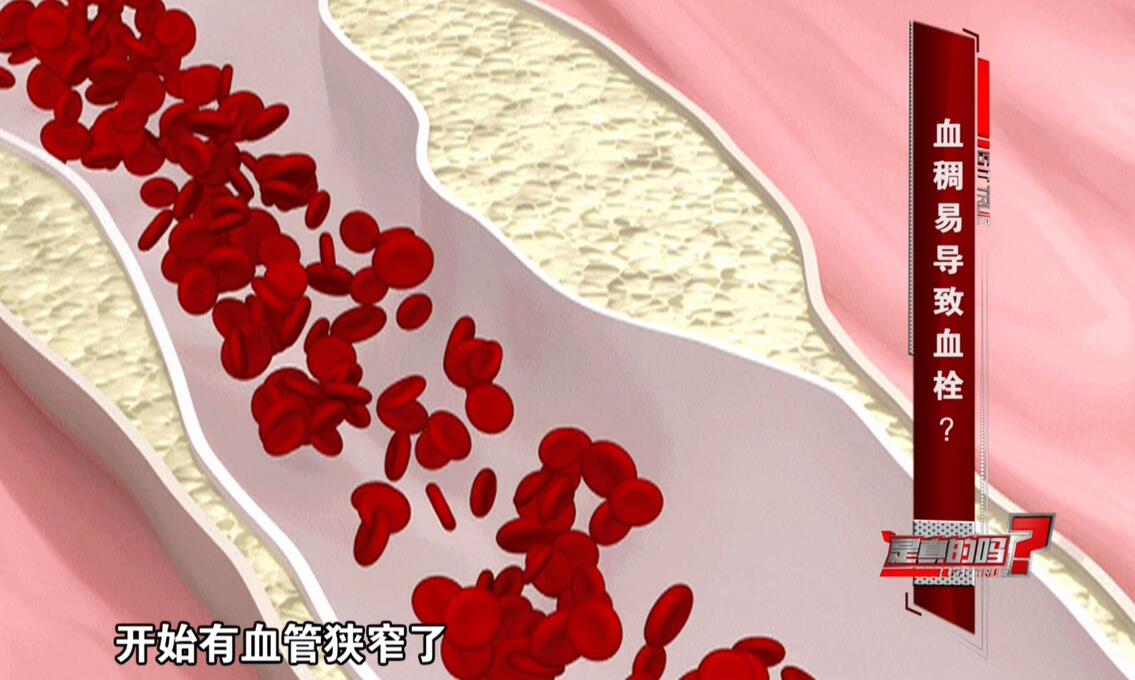 血稠会导致血栓真相原来是