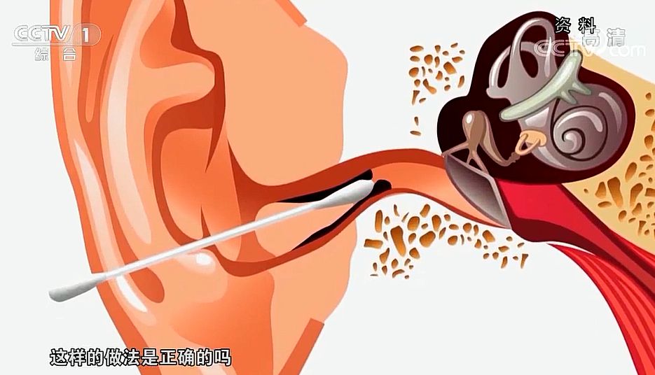 快看 健康 经常掏耳朵是一个好习惯吗 快看 健康 经常掏耳朵是一个好习惯吗