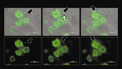 图中箭头所指的绿色自然杀伤细胞，其颜色变化源于从癌细胞获取了大片膜结构。癌细胞在此过程中扮演了“劫持者”角色，促使自然杀伤细胞进入休眠并成功躲避免疫系统的追击。 图片授权：《科学进展》期刊/哈希姆研究团队